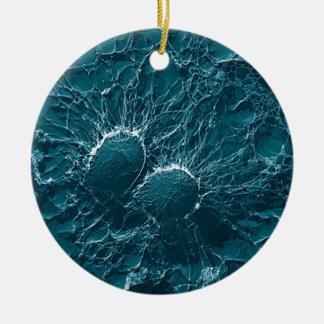 Bacterial cells of Staphylococcus Aureus Close Up Ceramic Ornament (Front)