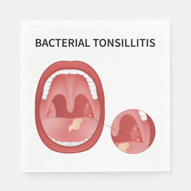 Bacterial tonsillitis napkin (Front)