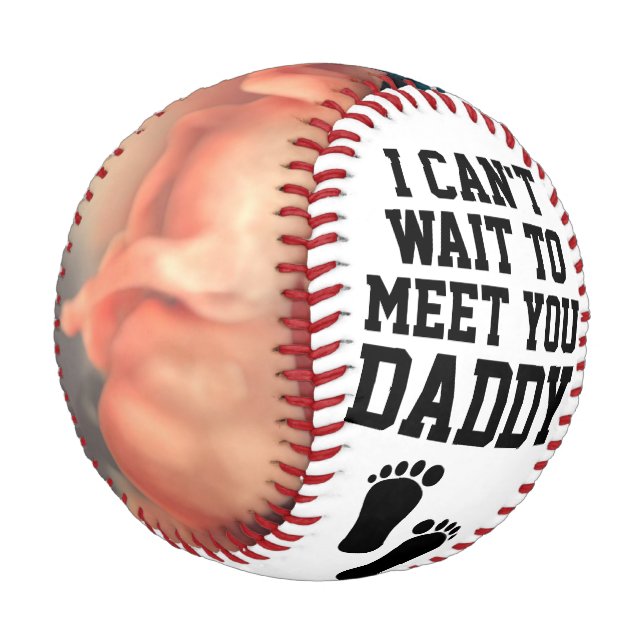 Balle De Baseball Sonogramme personnalisé Ultrasound Nouveau papa bé (Angle)