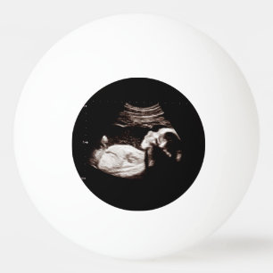 Balle De Ping Pong Faire-part de grossesse Sonogramme Ultrasound Phot
