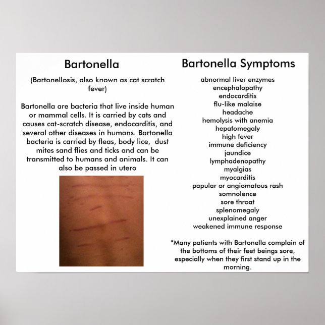 Bartonella Symptoms Educational Poster (Front)
