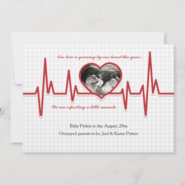 Beating Heart Photo Pregnancy Announcement (Front)
