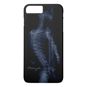 Beautiful, Personalized Body X-Ray iPhone 8 Plus/7 Plus Case