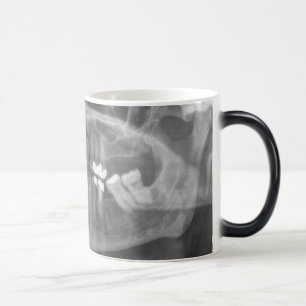 Big Smile Morphing Mug