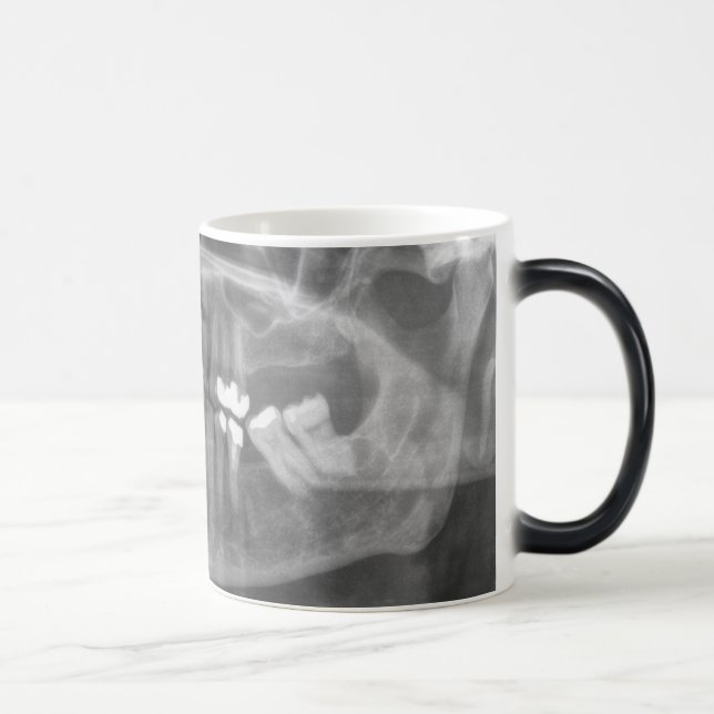 Big Smile Morphing Mug (Right)