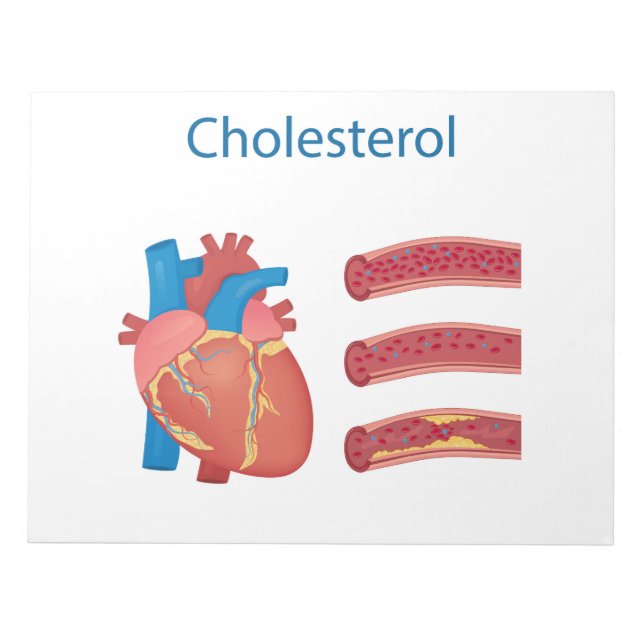 Bloc-note Cholestérol (Devant)