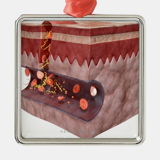 Blood Clot Formation Metal Ornament (Front)