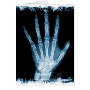 Blue X-ray Skeleton Hand