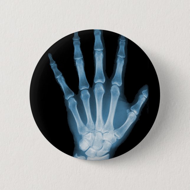 Blue X-ray Skeleton Hand 2 Inch Round Button (Front)