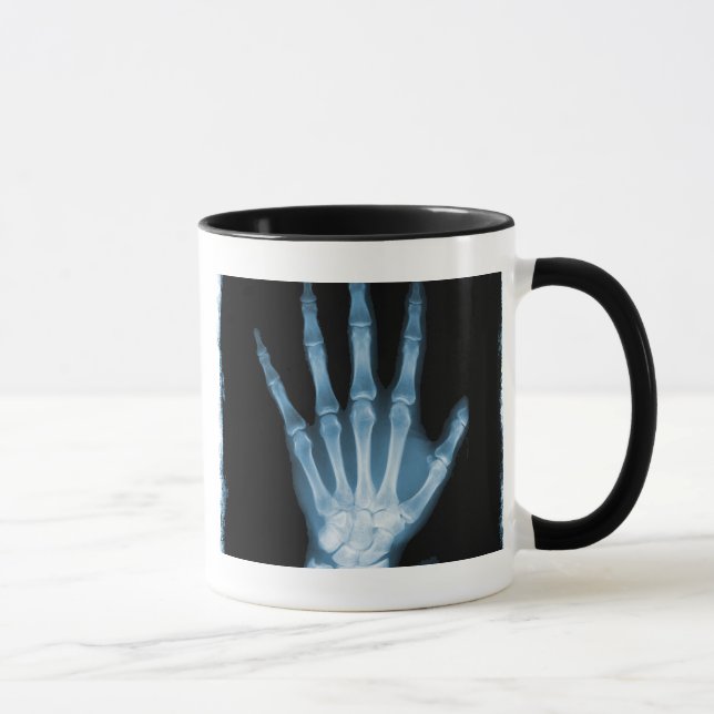 Blue X-ray Skeleton Hand Mug (Right)
