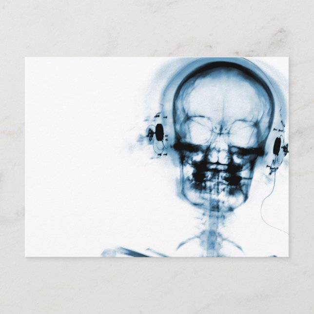 Blue X-Ray Vision Music Skeleton Skull Postcard (Front)