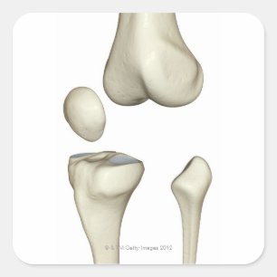 Bones of the Knee 5 Square Sticker