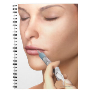 Botox Injections Notebook