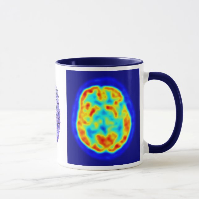 Brain image mug (Right)