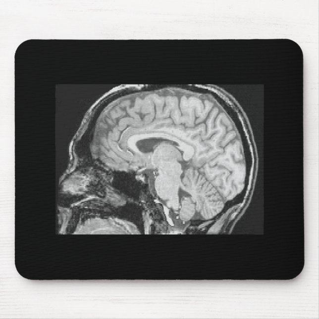 Brain MRI Mouse Pad (Front)