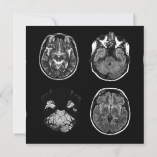 Brain MRI scan