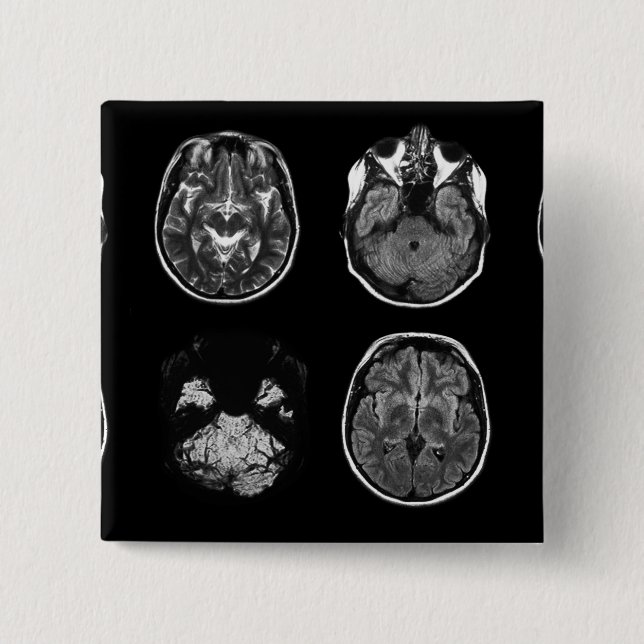 Brain MRI scan 2 Inch Square Button (Front)