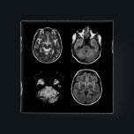 Brain MRI scan 2 Inch Square Button<br><div class="desc">Brain MRI scan design</div>