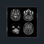 Brain MRI scan 2 Inch Square Button<br><div class="desc">Brain MRI scan design</div>