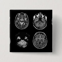 Brain MRI scan