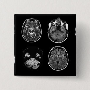 Brain MRI scan 2 Inch Square Button
