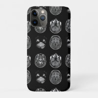 Brain MRI scan