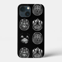 Brain MRI scan