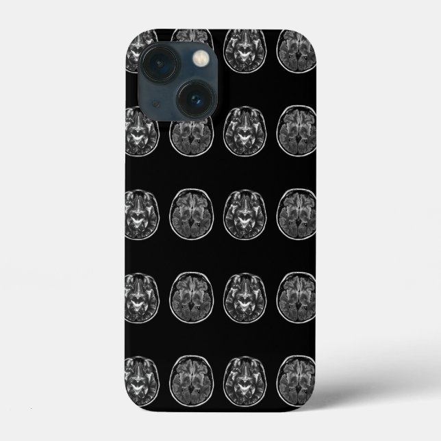 Brain mri scan Case-Mate iPhone case (Back)