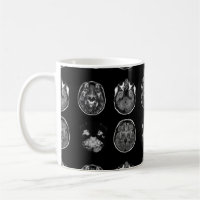 Brain MRI scan