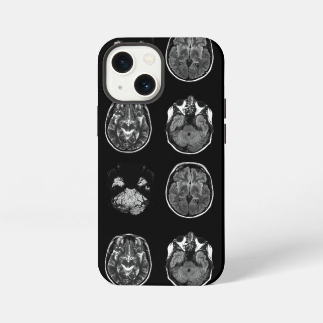 Brain MRI scan iPhone Case (Back)