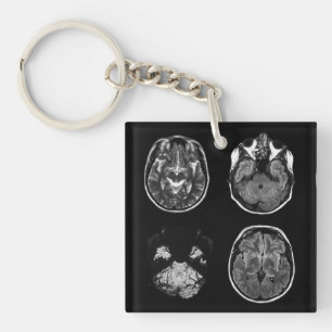 Brain MRI scan Keychain