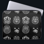 Brain MRI scan Laptop Sleeve<br><div class="desc">Brain MRI scan design</div>