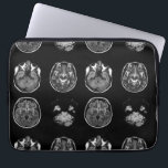 Brain MRI scan Laptop Sleeve<br><div class="desc">Brain MRI scan design</div>
