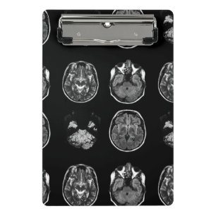 Brain MRI scan Mini Clipboard