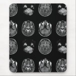 Brain MRI scan Mouse Pad<br><div class="desc">Brain MRI scan design</div>