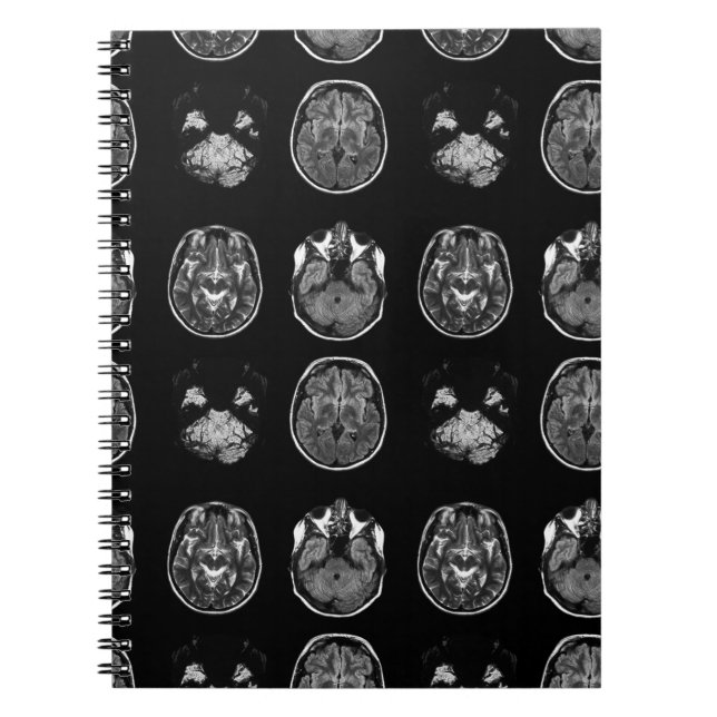 Brain MRI scan Notebook (Front)