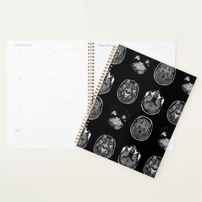 Brain MRI scan Planner (Display)