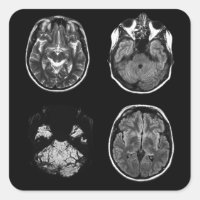 Brain MRI scan