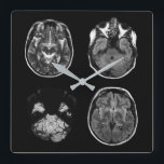 Brain MRI scan Square Wall Clock<br><div class="desc">Brain MRI scan design</div>