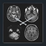 Brain MRI scan Square Wall Clock<br><div class="desc">Brain MRI scan design</div>