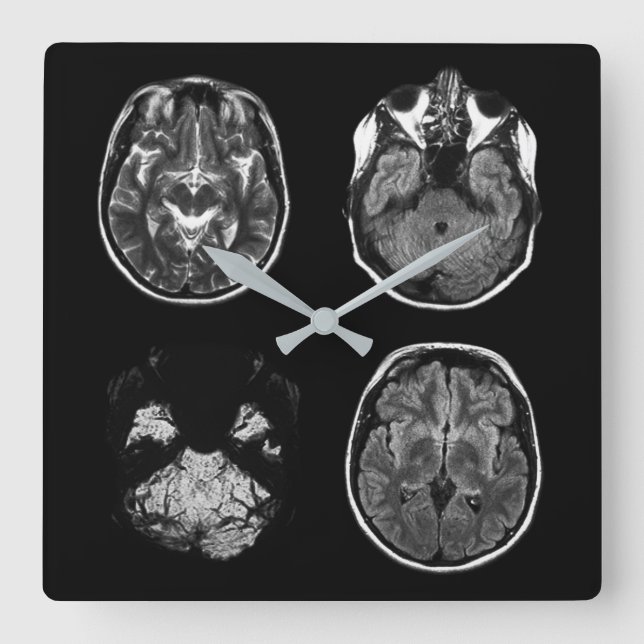Brain MRI scan Square Wall Clock (Front)