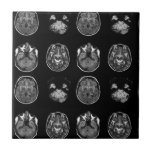 Brain MRI scan Tile<br><div class="desc">Brain MRI scan design</div>