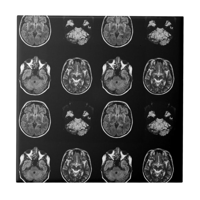 Brain MRI scan Tile (Front)