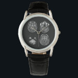 Brain MRI scan Watch<br><div class="desc">Brain MRI scan design</div>