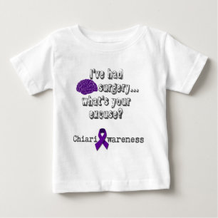 Brain Surgery Baby T-Shirt