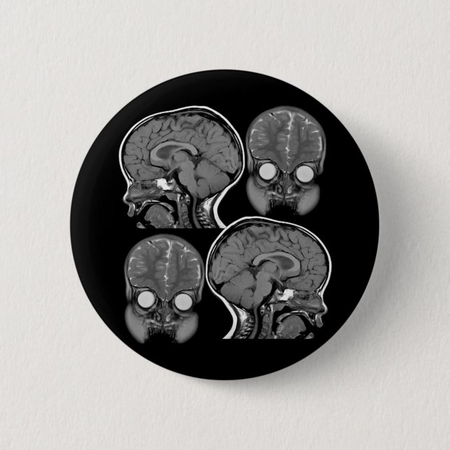 BRAINS! (MRI) 2 INCH ROUND BUTTON (Front)