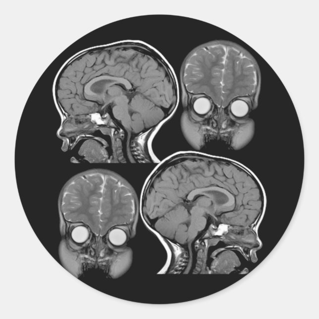 BRAINS! (MRI) CLASSIC ROUND STICKER (Front)