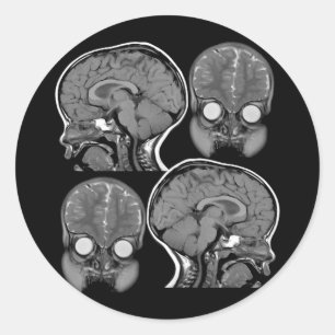 BRAINS! (MRI) CLASSIC ROUND STICKER