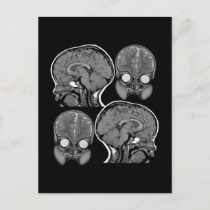 BRAINS! (MRI) POSTCARD
