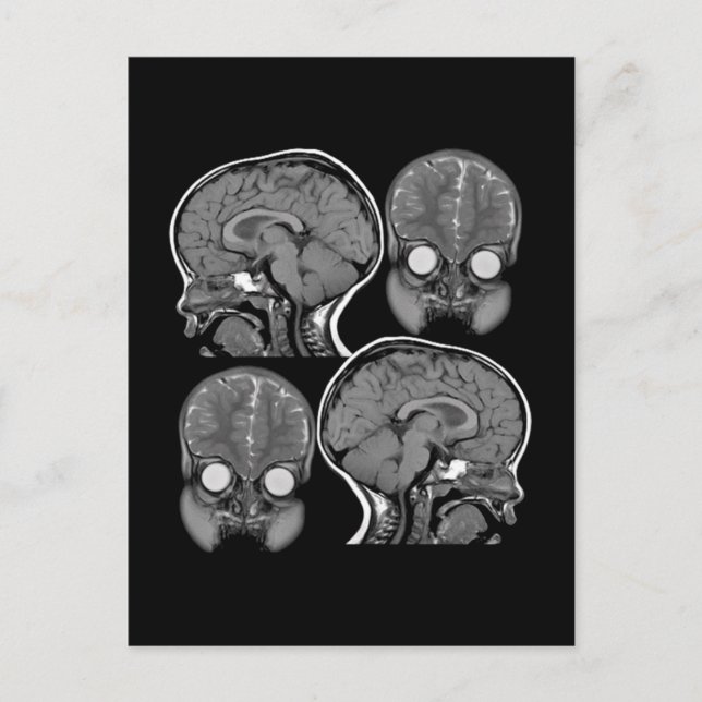 BRAINS! (MRI) POSTCARD (Front)